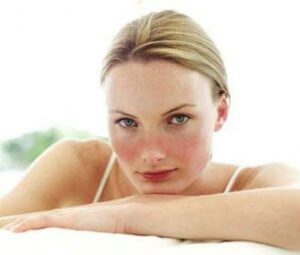 الذئبة الحمامية - اكتشف المزيد عن هذا المرض المناعي الذاتي