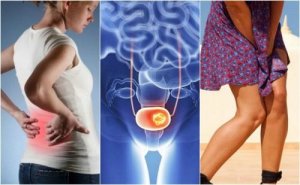 سرطان المثانة - اكتشف 7 علامات منذرة يجب عليك الانتباه لها