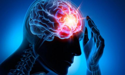 الأمراض الدماغية الوعائية - أنواع السكتات الدماغية الأكثر شيوعًا