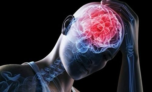 الانصمام الدماغي