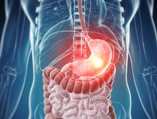 ما هي حالات عدم تحمل الطعام الرئيسية؟