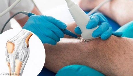 فوائد تنظير الركبة