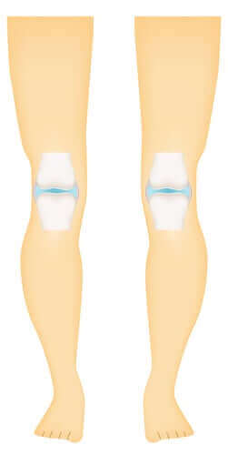 المفاصل حرة الحركة