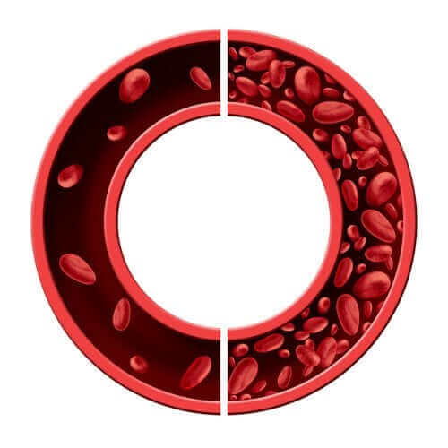 فقر الدم – كافح الأنيميا بهذه العلاجات الطبيعية الخمسة