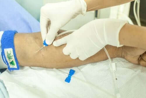 تنفيذ فغر الوريد المحيطي