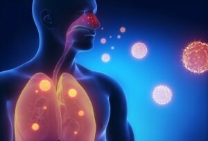 ثلاثة بدائل طبيعية لتخفيف أعراض الإنفلونزا