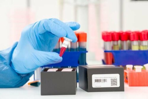 الكشف عن فيروس كورونا: ما هو اختبار تفاعل البلمرة التسلسلي (PCR) ؟