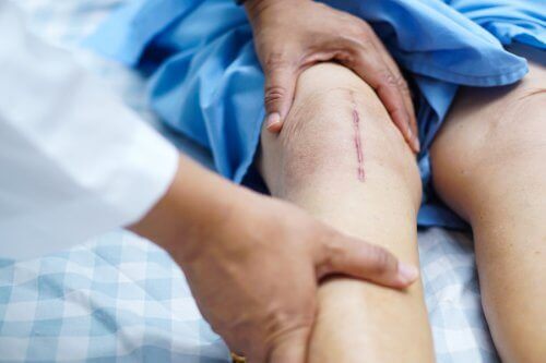 استبدال مفصل الركبة والتعافي بعد الجراحة