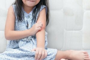 مرض الصدفية - كيفية التعامل مع مرض الصدفية في حالة الأطفال