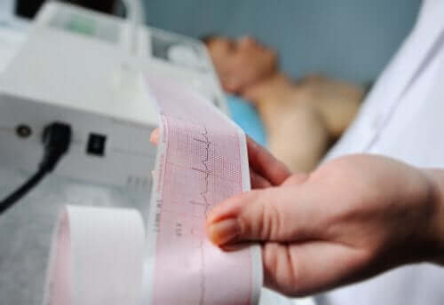مخطط كهربائية القلب أو (EKG): سبع خطوات لتفسيره
