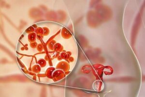 المفطورة التناسلية - المسببات، الأعراض والعلاج