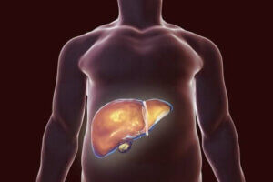 صحة المرارة - نصائح غذائية تساعدك على الحفاظ عليها وتجنب تشكل الحصوات
