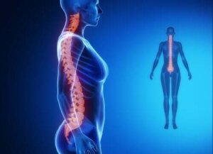 تشخيص وعلاج التهاب المفصل التنكسي في العمود الفقري