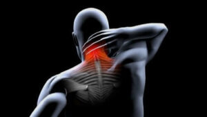 تقلص العضلات - الوقاية والعلاج