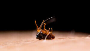 داء الطوامر: الأعراض والعلاج