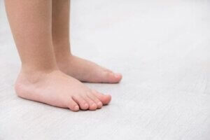 القدم المسطحة - السمات والعلاجات