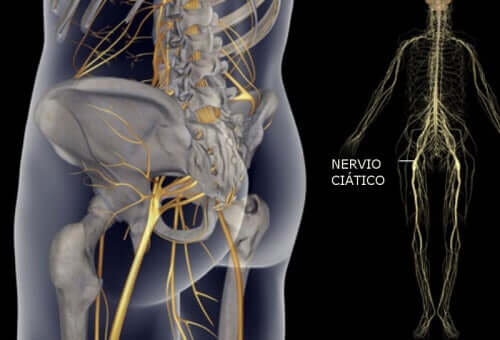 ألم العصب الوركي - تمارين بسيطة تساعدك على تخفيفه
