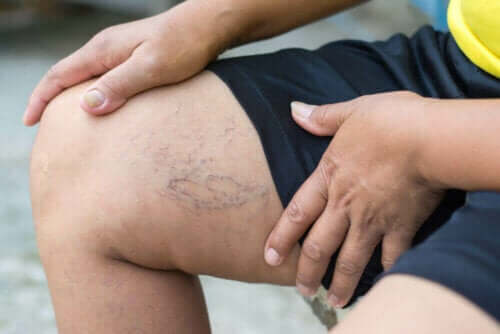 أعراض ضعف الدورة الدموية في الساقين والقدمين