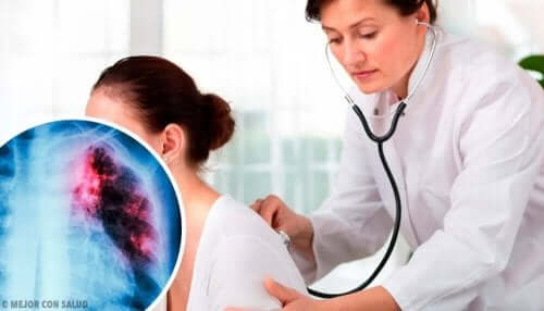 كيف يشخص الأطباء العقيدات الرئوية؟
