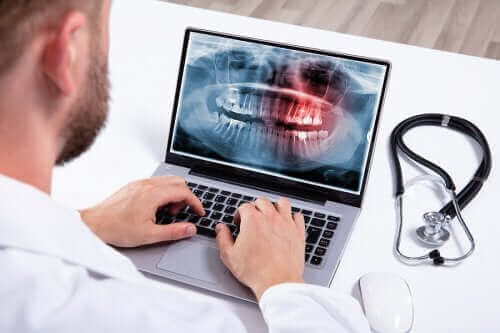 زيادة عدد الأسنان - الأسباب والعلاجات