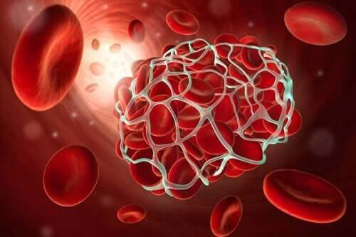التجلطات الدموية والسكتات الدماغية - 8 أطعمة تساعدك على تجنب هذه الحالات الخطيرة