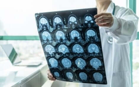 فحص الدماغ الدقيق