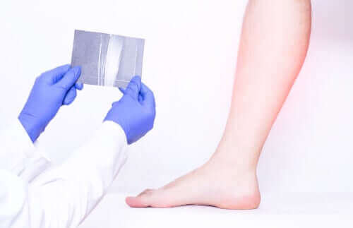 فحص تقلصات عضلات الساق