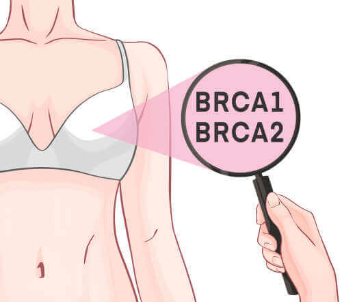 جينات BRCA-1 وBRCA-2 وسرطان الثدي