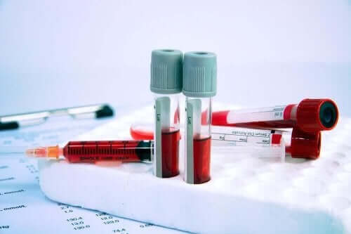أنابيب اختبار فقر الدم