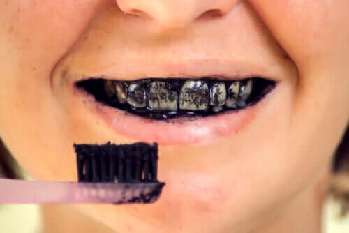 مخاطر الفحم النشط على صحة الفم