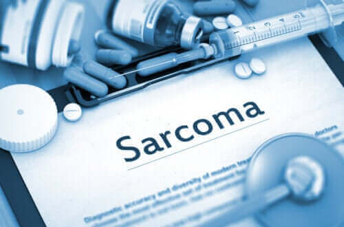 ورم الساركوما السرطاني: الخصائص والعلاجات