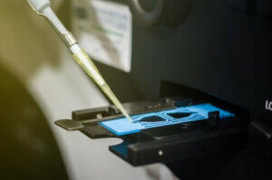 فحص السائل المنوي وكيفية تفسير نتائجه