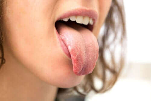 جفاف الفم - لماذا يعاني مرضى السكري من هذا العرض؟