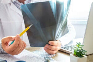 وذمة النخاع العظمي - كل ما تحتاج إلى معرفته عن الحالة