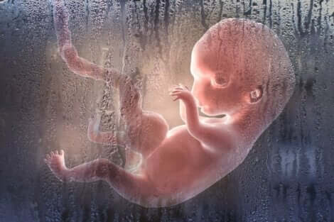 الإجهاض العمدي
