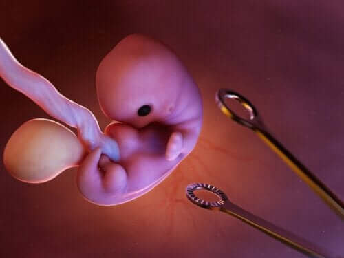 الإجهاض العمدي - على ماذا تشتمل هذه العملية؟
