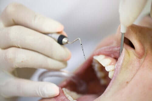 التهاب دواعم الأسنان - اكتشف مسبباته وأعراضه وكيفية علاجه