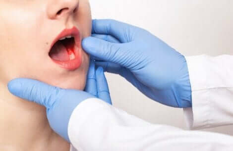 مسببات التهاب دواعم الأسنان