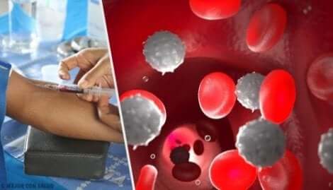 الآثار الجانبية للميتاميزول