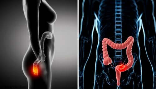 التنظير الشرجي