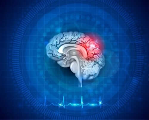 السكتة الدماغية - الإسعافات الأولية وطرق الوقاية