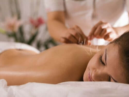 جلسة وخز بالابر