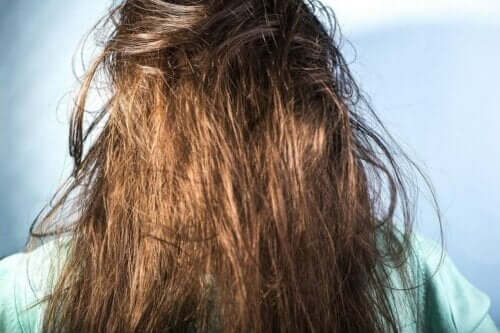 ما مسببات ظهور الشعر الدهني؟