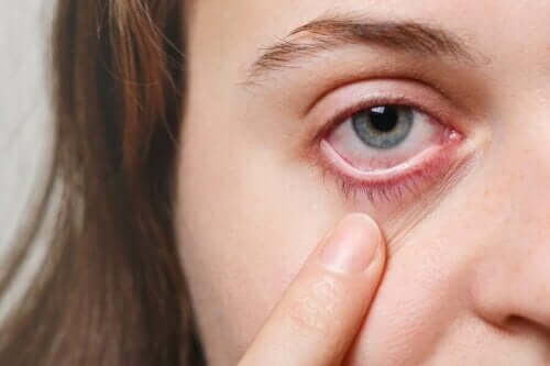 5 علاجات فعالة للتعامل مع أنواع عدوى العين