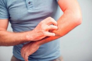 علاجات ووصفات طبيعية من أجل تهدئة مشكلة الحكة أو الهرش