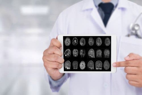 الضمور الجهازي المتعدد - أسباب وأعراض وعلاج الحالة