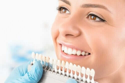 تبييض الأسنان – وصف وأنواع العمليات المختلفة المتاحة