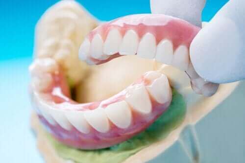 جسر الأسنان: أنواعه وفوائده وعيوبه