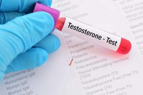 ما هي متلازمة نقص هرمون التستوستيرون؟