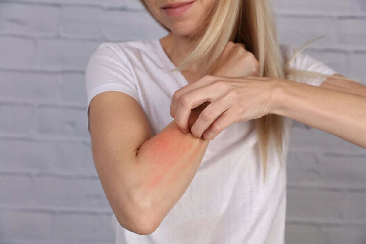الحكة والإنزعاج نتيجة الحساسية من الكهرباء